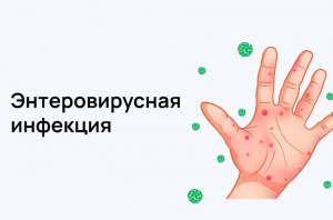 Внимание! Информация по энтеровирусной инфекции.